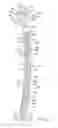 Fig. 02 - Bone fracture fixation system