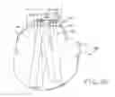 Fig. 22 - Bone fracture fixation system