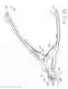 Fig. 28 - Bone fracture fixation system