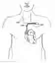 Fig. 01 - Heart failure management system