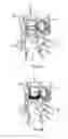 Fig. 09 - Neuromodulatory methods for treating pulmonary disorders