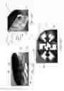 Fig. 09 - Method and apparatus for minimally invasive heart valve procedures