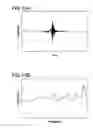 Fig. 09 - Audio signal processing apparatus and audio signal processing method