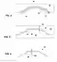 Fig. 03 - Method for molding artistic surfaces