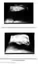 Fig. 06 - METHOD AND APPARATUS FOR IMAGING TISSUE TOPOGRAPHY