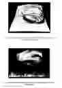 Fig. 07 - METHOD AND APPARATUS FOR IMAGING TISSUE TOPOGRAPHY