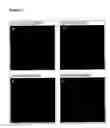 Fig. 07 - Compositions and methods for treatment of angiogenesis-associated ocular disorders