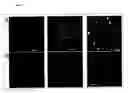 Fig. 09 - Compositions and methods for treatment of angiogenesis-associated ocular disorders