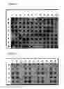 Fig. 02 - Compositions and Methods for Treating S. Pneumonia Infection