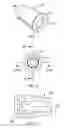 Fig. 04 - Components, Systems and Related Methods for Temporary Prosthetics