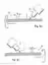 Fig. 08 - Dental fixture