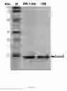 Fig. 13 - Independently Inducible System of Gene Expression