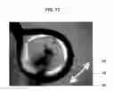 Fig. 13 - Aligned polymers including bonded substrates