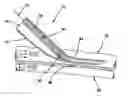 Fig. 01 - Systems and methods for creating arteriovenous (AV) fistulas