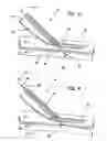 Fig. 03 - Systems and methods for creating arteriovenous (AV) fistulas