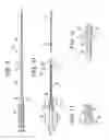 Fig. 06 - EMBOLIC PROTECTION SYSTEM