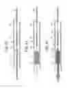 Fig. 22 - EMBOLIC PROTECTION SYSTEM