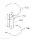 Fig. 01 - INTERSPINOUS DEVICE AND METHOD OF IMPLANTING