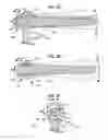 Fig. 07 - Adaptive spinal rod and methods for stabilization of the spine