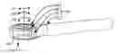 Fig. 01 - ADAPTIVE SPINAL ROD AND METHODS FOR STABILIZATION OF THE SPINE