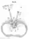 Fig. 22 - ADAPTIVE SPINAL ROD AND METHODS FOR STABILIZATION OF THE SPINE