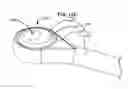 Fig. 35 - ADAPTIVE SPINAL ROD AND METHODS FOR STABILIZATION OF THE SPINE