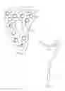 Fig. 04 - System for Treating Bone Fractures