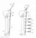 Fig. 22 - System for Treating Bone Fractures