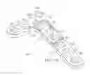 Fig. 33 - System for Treating Bone Fractures