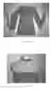 Fig. 19 - Convertible Garment