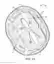 Fig. 14 - Protective headgear