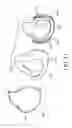 Fig. 45 - Full face respiratory mask with integrated nasal interface