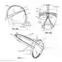 Fig. 06 - Sleep disorder relief device and method