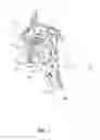 Fig. 02 - Systems and methods for treatment of sleep apnea