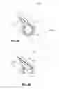 Fig. 08 - Systems and methods for treatment of sleep apnea