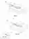 Fig. 10 - Systems and methods for treatment of sleep apnea