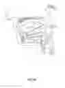 Fig. 19 - Systems and methods for treatment of sleep apnea