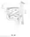 Fig. 23 - Systems and methods for treatment of sleep apnea