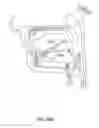 Fig. 33 - Systems and methods for treatment of sleep apnea