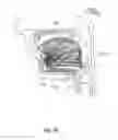 Fig. 34 - Systems and methods for treatment of sleep apnea