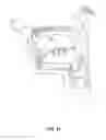 Fig. 41 - Systems and methods for treatment of sleep apnea
