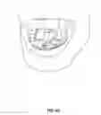Fig. 43 - Systems and methods for treatment of sleep apnea
