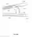Fig. 45 - Systems and methods for treatment of sleep apnea
