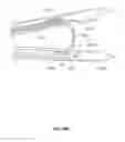 Fig. 46 - Systems and methods for treatment of sleep apnea