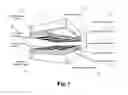 Fig. 02 - Plasma panel based ionizing radiation detector