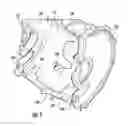 Fig. 06 - Electric motor assemblies including stator and/or rotor cooling