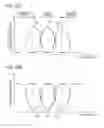 Fig. 49 - Solid-state imaging device with photoelectric conversion region that is not transparent