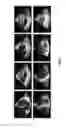 Fig. 02 - Echocardiogram view classification using edge filtered scale-invariant motion features