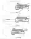Fig. 16 - Receiver assembly for an inflatable ear device
