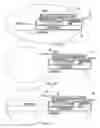 Fig. 17 - Receiver assembly for an inflatable ear device